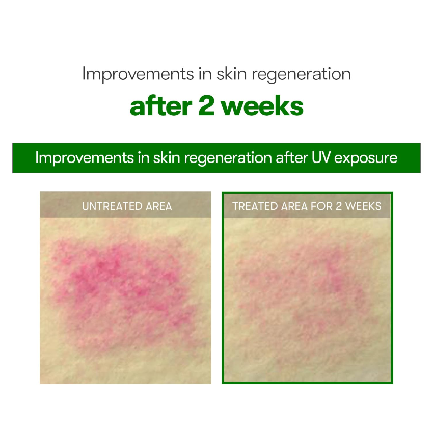 VT|REEDLE SHOT 700 積雪草塗抹式微針 700精華 30ml【平行進口產品】