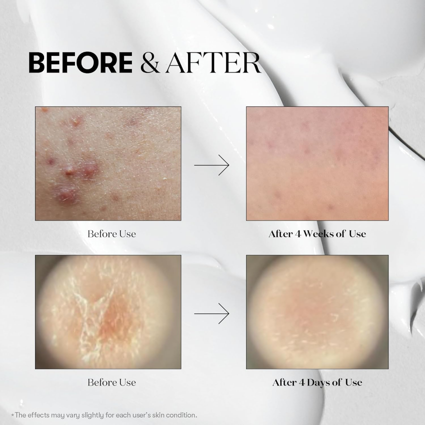 VT|REEDLE SHOT 700 積雪草塗抹式微針 700精華 30ml【平行進口產品】