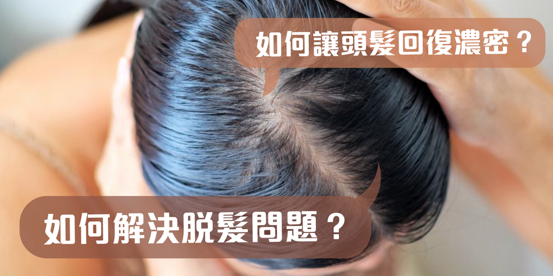 拯救髮際線，輕鬆讓頭髮回復濃密！