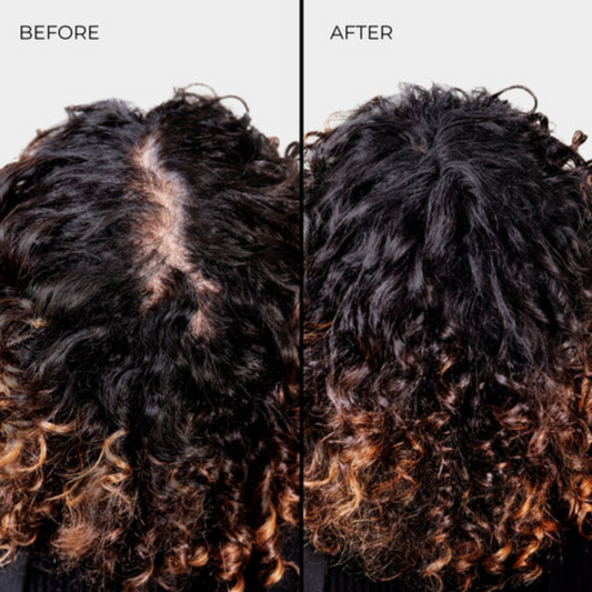 Nanogen | HAIR FIBRES Ultra-fine pure natural keratin hair nanofibers - Black/Dark Brown