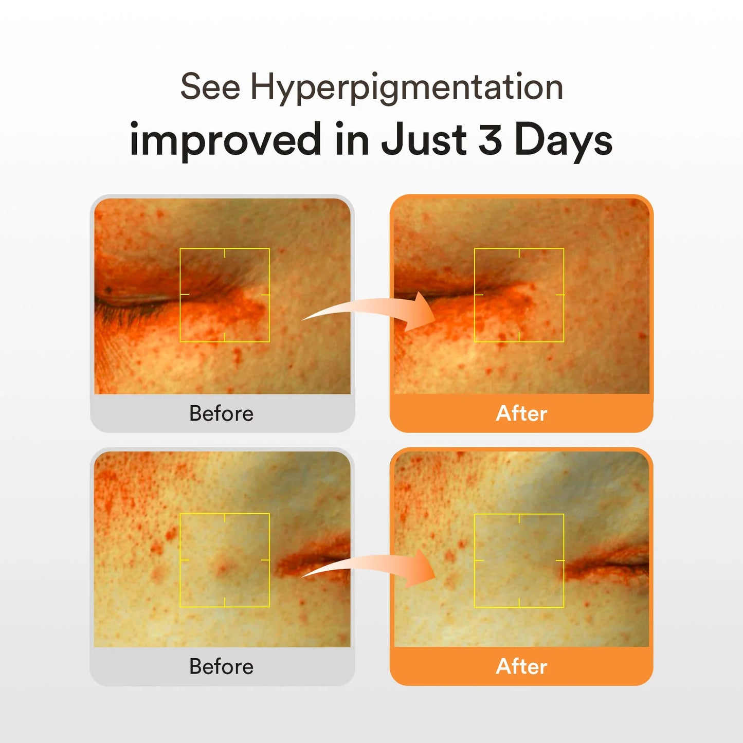 Abib｜韓國 穀胱甘肽淡斑精華液 50ml【平行進口產品】