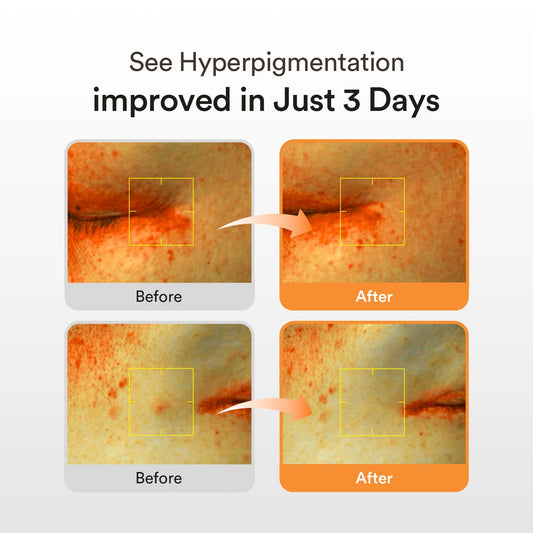 Abib｜韓國 穀胱甘肽淡斑精華液 50ml【平行進口產品】